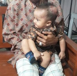 Balita 7 Bulan Pengidap Tumor di Kepala Butuh Uluran Tangan